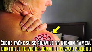 ČUDNE OKRUGLE TAČKE SE IZNENADA POJAVILE NA NJENOM RAMENU DOKTOR TO VIDIO I ODMAH POZVAO POLICIJU [upl. by Coral]