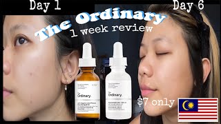 I tried The Ordinary Niacinamide amp Rosehip oil for 7 days  Honest Review Malaysia [upl. by Enaira]