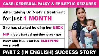 Case CP amp Epileptic Seizures Part 24  Dr Nishi’s Treatment Result – After 1 month [upl. by Marcelia]