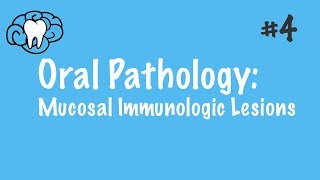 Oral Pathology  Mucosal Immunologic Diseases  INBDE ADAT [upl. by Lorn]