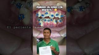 Si serán exagerados  No duele tanto  dentista humor [upl. by Anrev]