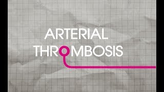 Arterial Thrombosis Explained [upl. by Orella]