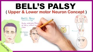 Bells palsy Upper and Lower Motor Neuron Lesions  Simplified [upl. by Kenimod]