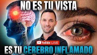 ¿Vista Borrosa Desinflama tu Cerebro en Lugar de Usar Anteojos [upl. by Nois]