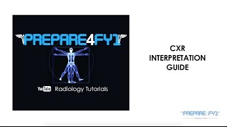 CXR Interpretation Guide [upl. by Ymar]