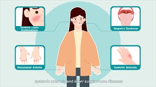 APS and the diagnosis [upl. by Netsreik]