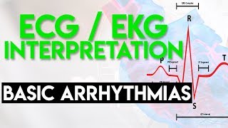 Basic Arrhythmias  Sinus Brady Tachy Premature Beats  ECG EKG Interpretation Part 3 [upl. by Neelear]