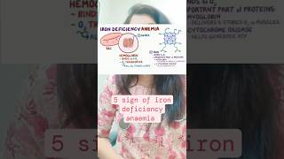 5 sign of iron deficiency anaemia on skin nails and hair irondeficiencyanaemia heathvideos [upl. by Yeliab]