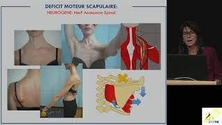 J2N 2018  Session  Myasthénie et myopathies [upl. by Rennold669]