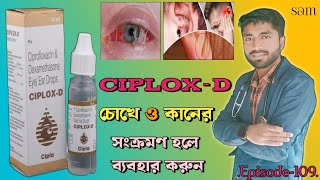 Ciplox D Eye Ear Drops❓Ciprofloxacin Dexamethasone Eye Ear Drops❓Ciplox D Drops [upl. by Doughty971]