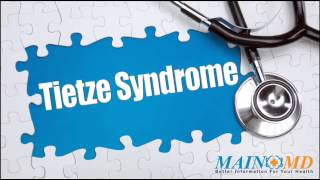 Tietze Syndrome ¦ Treatment and Symptoms [upl. by Mian]