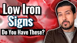 7 SIGNS of Iron Deficiency to Catch Now  Iron Deficiency Without Anemia [upl. by Eilyk153]