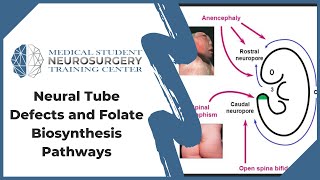 Neural Tube Defects and Folate Biosynthesis Pathways [upl. by Asilef455]