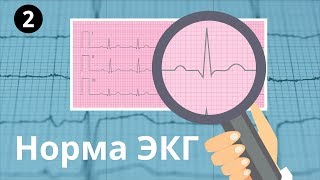 Норма ЭКГ Все интервалы и зубцы p QRS T PR ST [upl. by Toms]