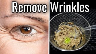 Remove WRINKLES in 7 days Completely with Instant Skin Tightening Remedy Skincare Beauty Tips [upl. by Elizabet599]