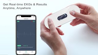 Wellue Handheld EKG MONITOR WITH OLED SCREEN [upl. by Eckmann990]