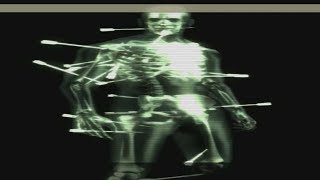 MGS3  How many arrows can Snake have stuck in his body [upl. by Thenna]