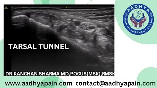 Ultrasound of the Tarsal Tunnel [upl. by Aniara135]