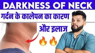 गर्दन और घुटने के कालापन से छुटकारा 🔥 Darkness Of Neck Treatment  Acanthosis Nigricans In Hindi [upl. by Ellehcam]