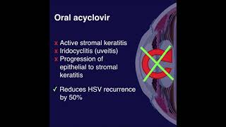 HEDS  Herpetic Eye Disease Study [upl. by Constantino379]