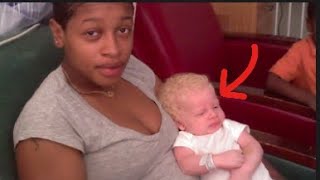 A Mom Gives Birth to Two Albino Kids and Gets Real About Her Extraordinary Family [upl. by Shoifet330]