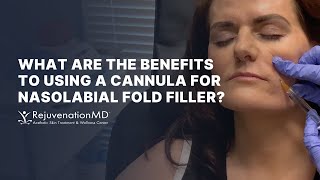 Cannula Artistry Transforming Nasolabial Folds with Filler [upl. by Shelden676]