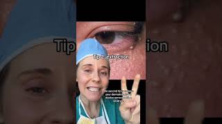 3 Dermatologist tips for removing milia the small bumps that are common on eyelid skin milia [upl. by Amlez]