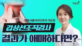 갑상선조직검사 결과가 애매하다면땡큐서울이비인후과 이은정 원장 [upl. by Perrin]