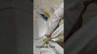 Oxidase test [upl. by Tertia]