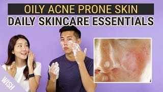 Best Daily Skincare Essentials for Oily Acne Prone Skin  WishTryLove [upl. by Esyle]