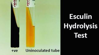 Esculin Hydrolysis Test A biochemical test for Esculinase Enzyme Producing Bacteria [upl. by Luisa822]