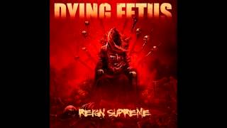 Dying Fetus  Second Skin [upl. by Adiari79]