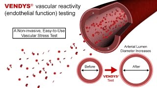 VENDYS  Endothelial Function Measurement Explained [upl. by Okia]