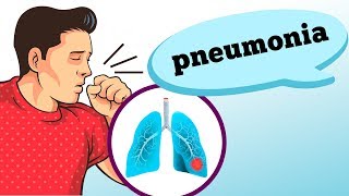 O QUE É PNEUMONIA QUAIS SUAS CAUSAS E SINTOMAS [upl. by Airdnas]