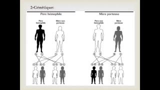 HEMATOLOGIE HEMOPHILIE [upl. by Frendel716]