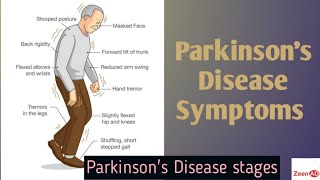 Clinical Presentation Of Parkinson DiseaseStages Of Parkinson DiseaseParkinsons Disease Symptoms [upl. by Galliett]