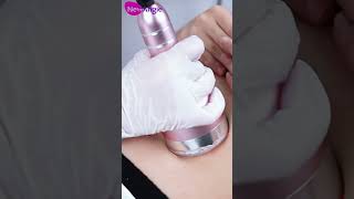 How to use cavitation radio frequency machine for weight loss treatment [upl. by Kamerman]