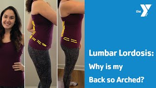 Lumbar Lordosis Why is my Back so Arched [upl. by Zeta]