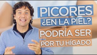 ¿PICORES POR EL CUERPO La causa podría estar en tu hígado [upl. by Juley]