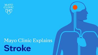 Mayo Clinic Explains Strokes [upl. by Joerg]