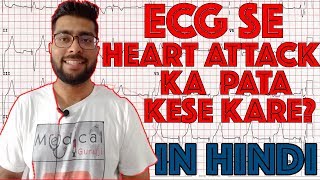 ECG reading in Hindi Language part 2  How to read ECG signal part 2  Medical Guruji [upl. by Nahtahoj697]