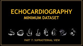 Echocardiogram Minimum dataset PART 7 Suprasternal view [upl. by Suired]