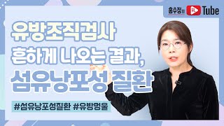 유방조직검사 하면 흔히 나오는 결과 섬유낭성 질환 [upl. by Aiyt]