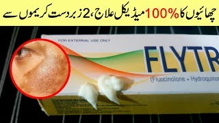 Remove Freckles amp Melasma on Face with Hyderquin Plus amp Flytro Cream Urdu Hindi [upl. by Margarita]