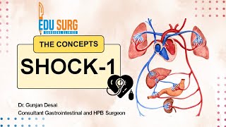 Understanding Shock l Pathophysiology of shock l Blalock classification l Types of shock [upl. by Okajima]