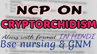 Nursing care plan on CRYPTORCHIDISM child health nursingmedical surgical nursingGNMBSC [upl. by Rapp]