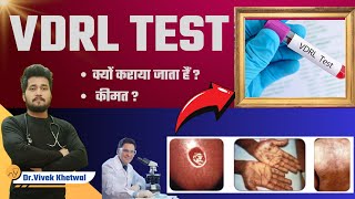 VDRL Test l VDRL Test In Hindi l Dr Vivek Khetwal vdrl youtube [upl. by Leizahaj311]