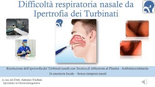 Difficoltà respiratoria nasale da Ipertrofia dei Turbinati [upl. by Etteiluj]