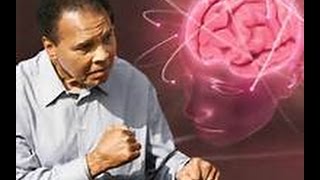 Cure Parkinsons disease with Parkinsons breakthrough method 2016 [upl. by Oren]