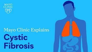 Mayo Clinic Explains Cystic Fibrosis [upl. by Dusty834]